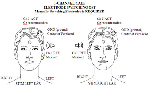 Automated cortical auditory evoked potentials threshold estimation in neonates - ScienceDirect