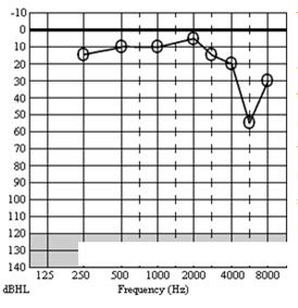 Automated cortical auditory evoked potentials threshold estimation in neonates☆