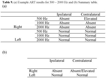 Acoustic reflex thresholds for pure tone stimuli (solid line) versus